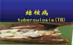 结核工作计划优秀6篇